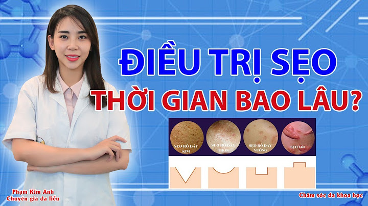 Trị sẹo rỗ lâu năm bao nhiêu tiền