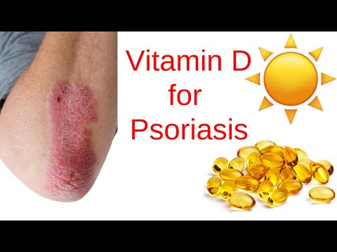 Video: Vitamin D Untuk Psoriasis: Manfaat, Kegunaan, Dan Pilihan Topikal