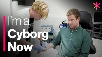 I Got a Chip Implanted in a Biohacking Garage