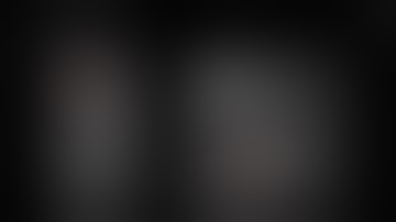 Hamstring Tendon Rupture