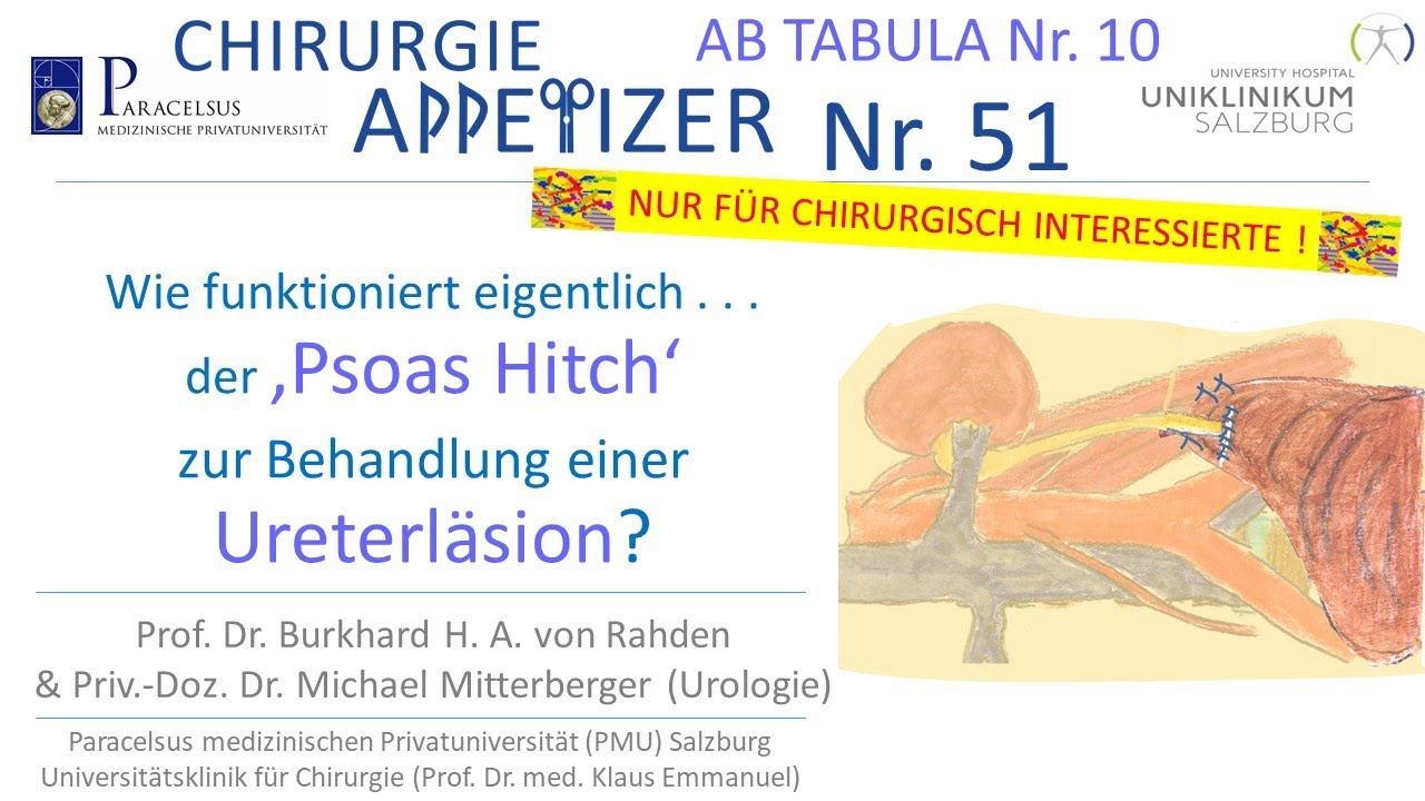 Wie funktioniert eigentlich ‚Psoas Hitch‘ bei Ureterläsion? CHIRURGIE APPetizer Nr.51 AB TABULA 10