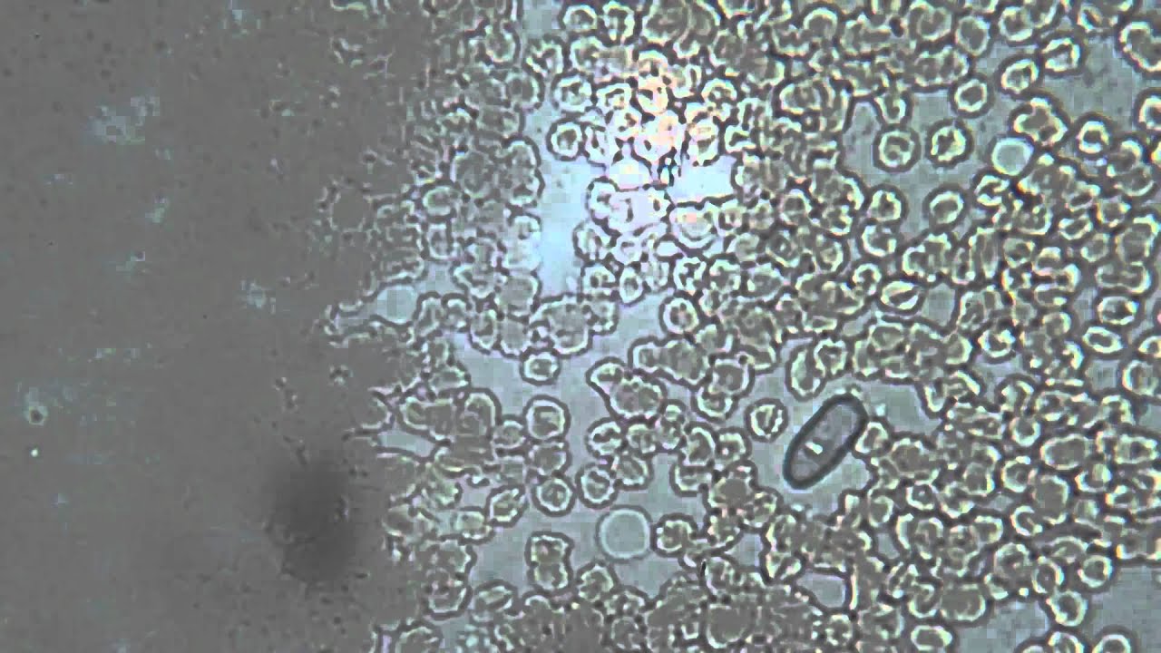 LP Microscope! Ep 6: Blood! - YouTube