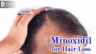 Kirkland Minoxidil Hair Regrowth Treatment Medicines 60 Ml