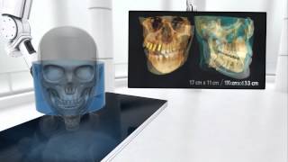 CS 9300 Product Video 1080p EN