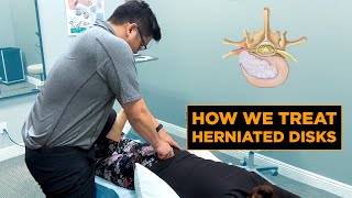 How We Treat a Herniated Disk | Physical Therapy