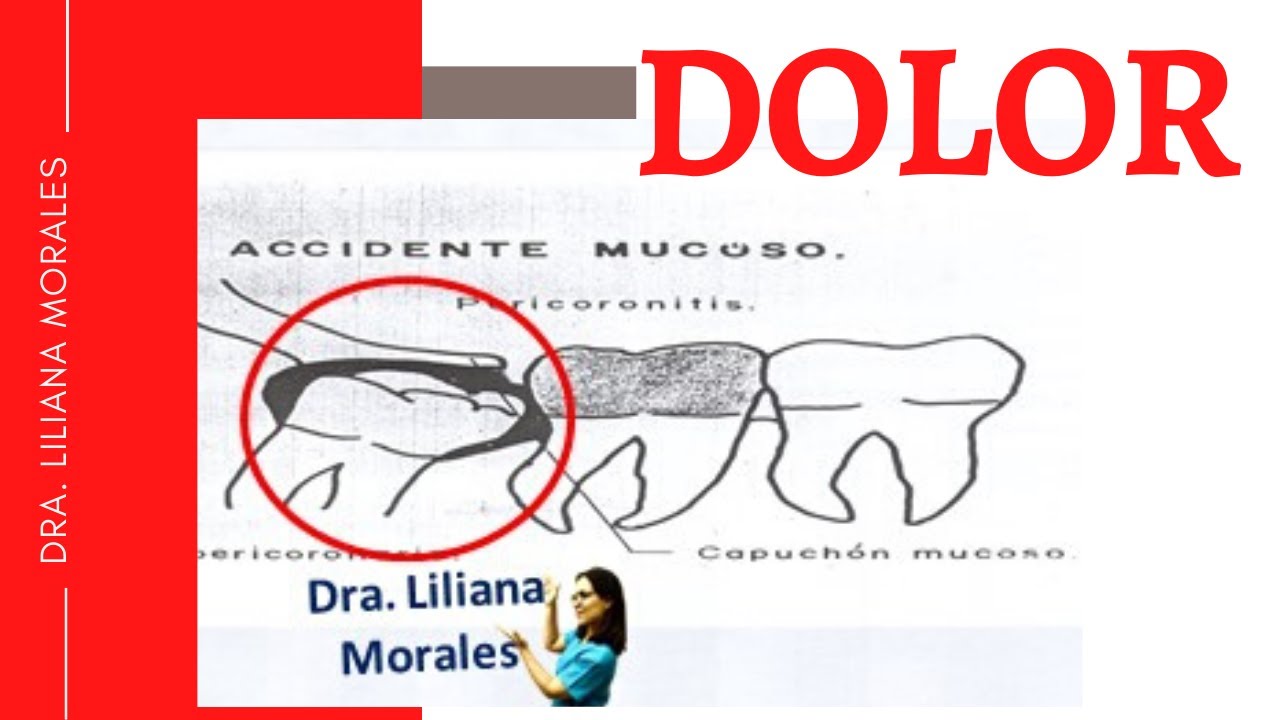 cuanto dura un dolor de muelas