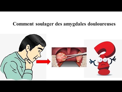 Vidéo: 3 façons de distinguer les infections virales et bactériennes