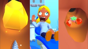 EarWax Clinic Game 3D New Max Level Gameplay Walkthrough Update Trailer iOS, Android Mobile Game.