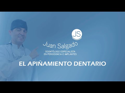 El Apiñamiento Dentario Odontologia Practica