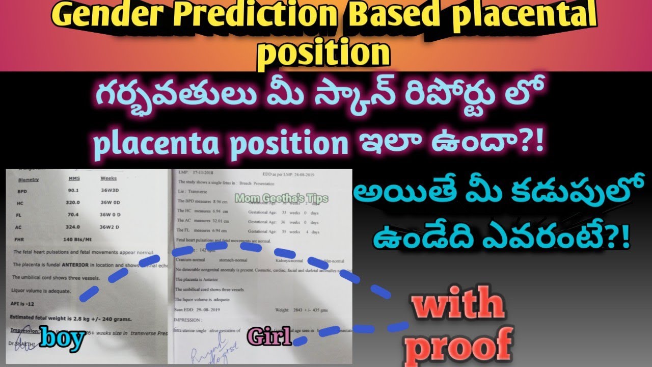 genderprediction Based On Placenta Position Boy Or Girl Symptoms genderprediction-based-on-placenta-position-boy-or-girl-symptoms