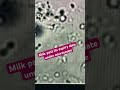 A drop of rotten milk under my microscope # medical