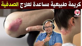 كريمة طبيعية مساعدة لعلاج الصدفية من عند الدكتور عماد ميزاب