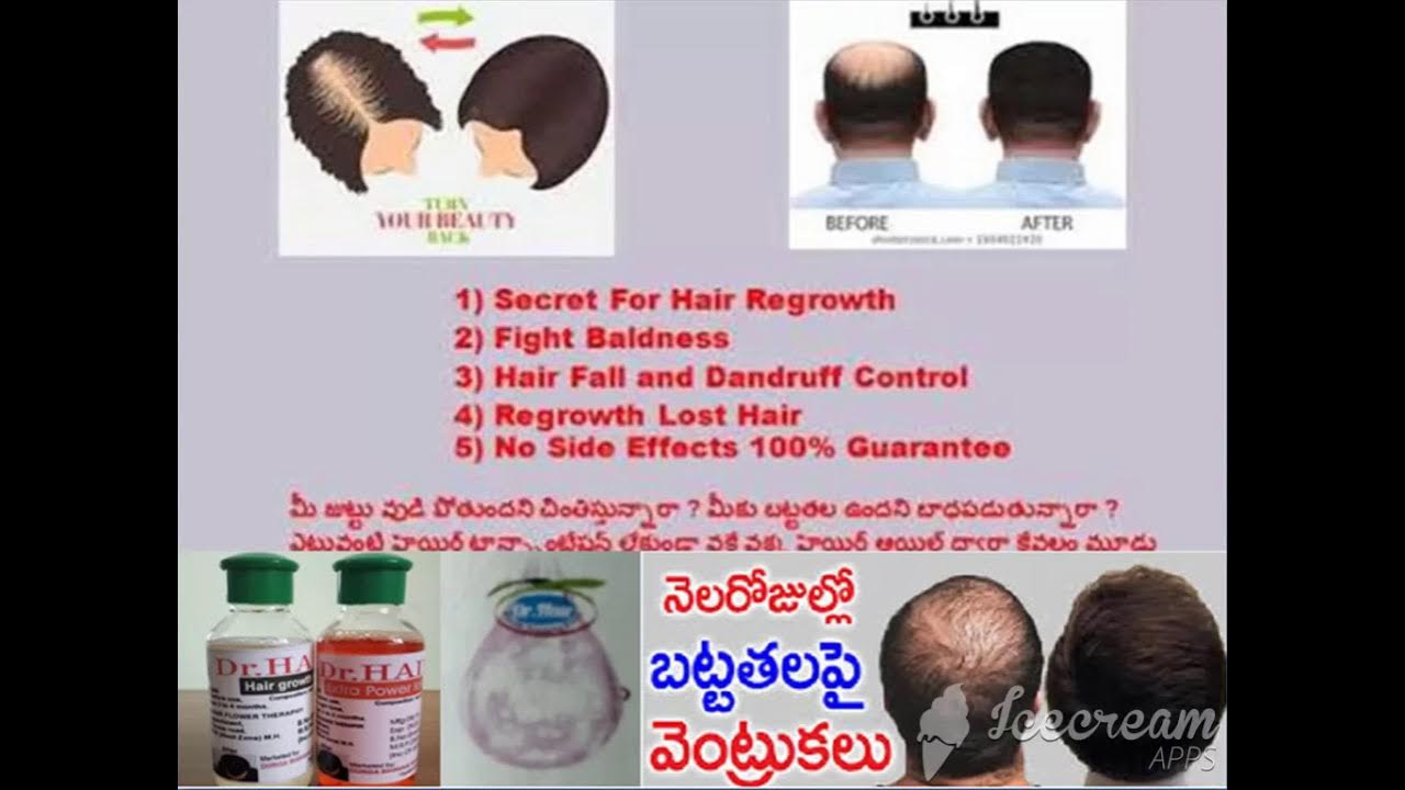 Dr Hair Growth Lotion Very Genuine YouTube