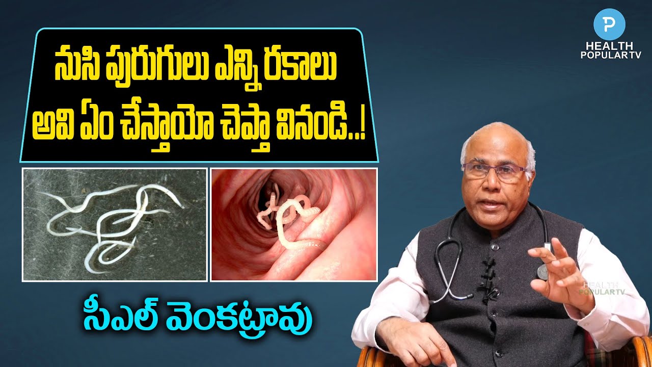 Dr Cl Venkat Rao About Intestinal Worms | Telugu Health Tips | Health Popular