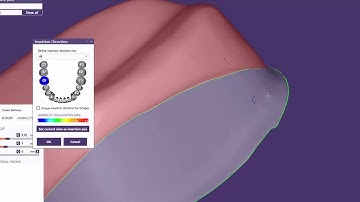 exocad Video Tutorial  Introduction to Basic Features    Offset Coping Design