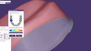 exocad Video Tutorial  Introduction to Basic Features    Offset Coping Design