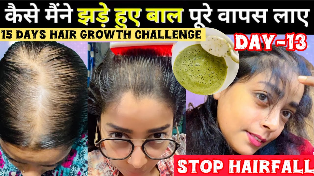 ✨15 Days Hair Growth Challenge👍Days-13💕Extreme  Growth Challenge🌿2 Steps Only👌