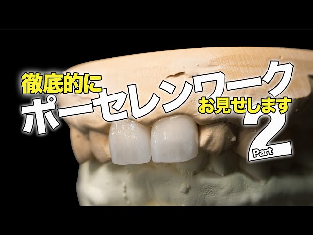 歯根付きポーセレンサンプル模型 - その他