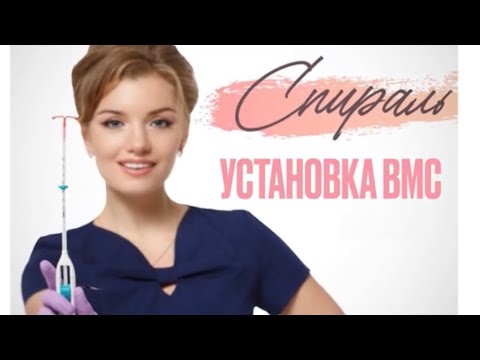 Внутриматочная спираль. Установка ВМС «Мирена».