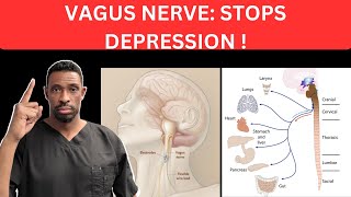 Vagus Nerve Stimulation How It Can Help Permanently Stop Depression