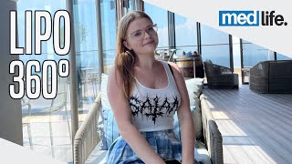 Anna's Medical Journey in Turkey | Lipo 360° Surgery