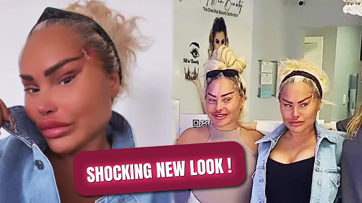 Darcey Silva Shocks Fans With Scary Snatched Face ...