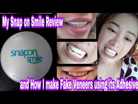 Snap On Smile Review | How Do I Make Fake Veneers Using Its Adhesive