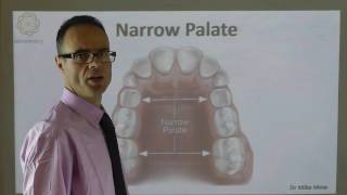 A Narrow Palate By Dr Mike Mew