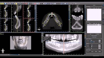 Blue Sky Plan Training Tutorial: Loading Patient Photo in 3D View