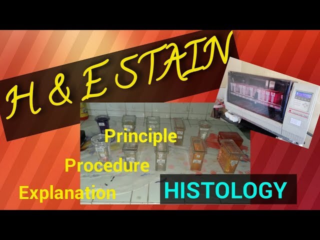 H and E staining procedure/H and E staining Histology/Hematoxylin and Eosin stain/STAR LABORATORY class=