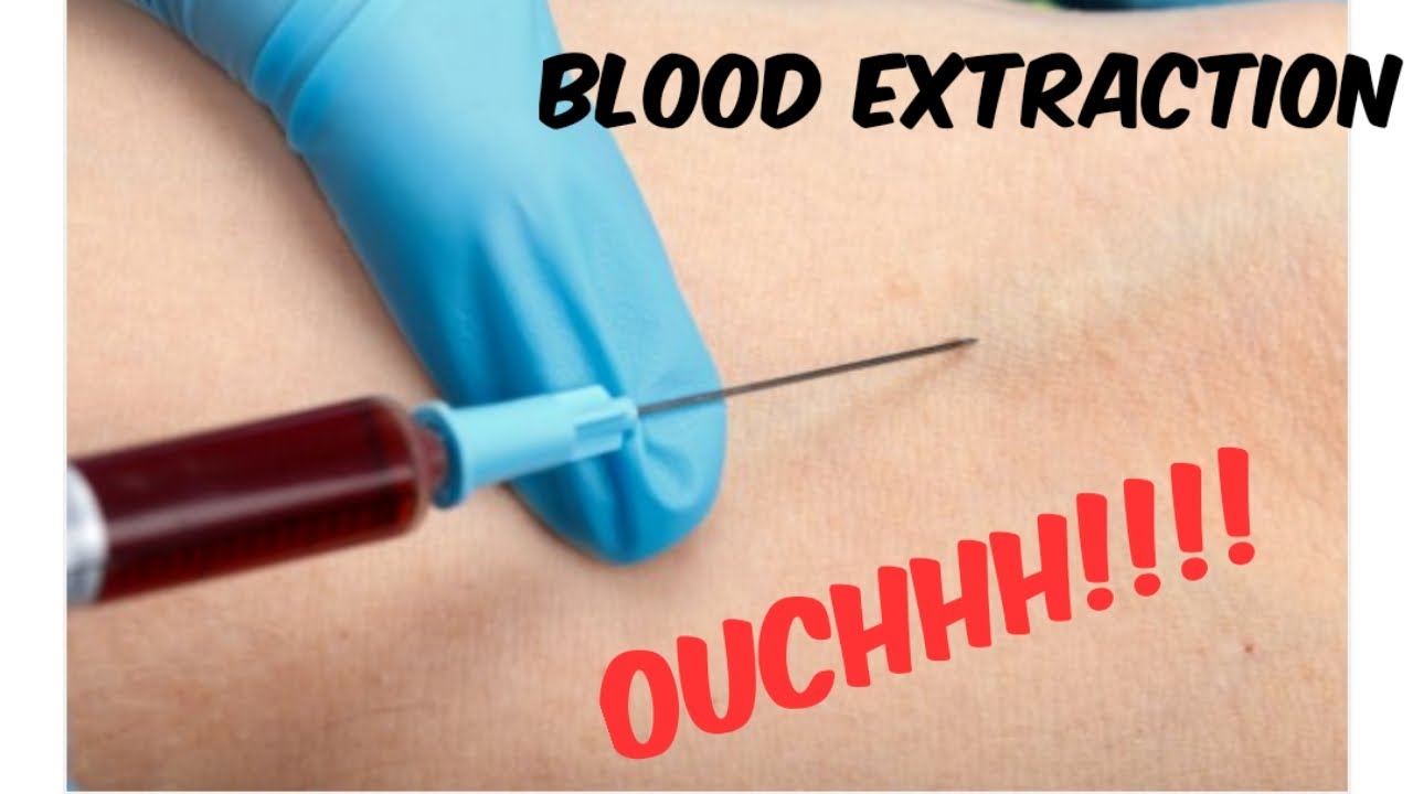 CBC Test Blood Extraction completebloodcount bloodchem bloodtest