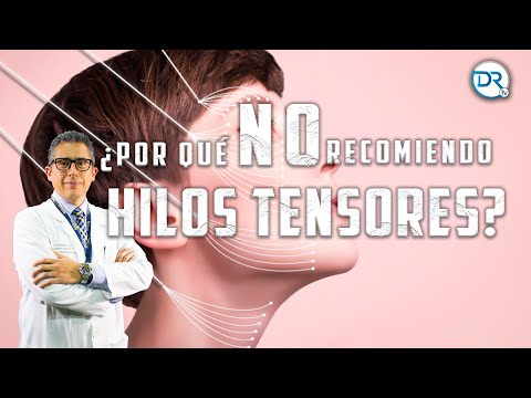 Video: ¿Qué puede causar el rejuvenecimiento del arroyo?