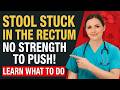 Stool Stuck in the Rectum? Doctor Explains Constipation Relief & Warning Signs After 60