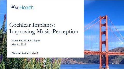Cochlear Implants: Improving Music Perception