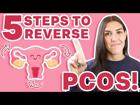 Video: 3 Mga Paraan upang Ma-minimize ang Mga Sintomas ng Polycystic Ovary Syndrome (PCOS) Sa Mga Suplementong Herbal, Pagkaing at Pag-eehersisyo