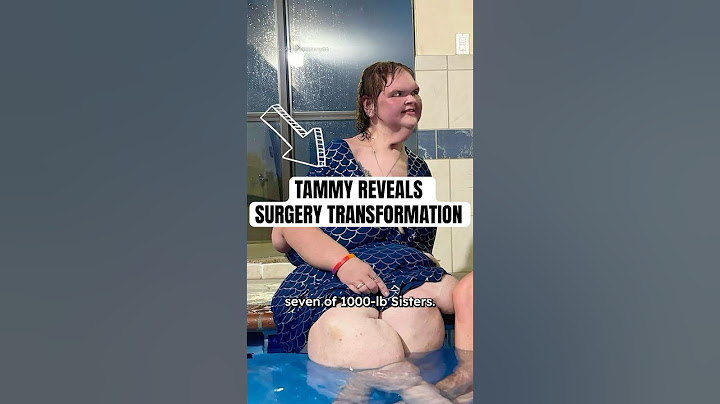 1000lb Sister Tammy’s Epic Transformation #shorts #1000lbsisters #weightloss