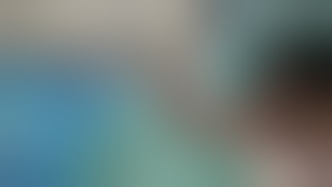 Infected Non Union Tibia