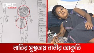 জন্মদিনের মোমের আগুনই কাল হল এতিম মীমের | DBC NEWS Special