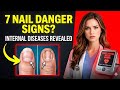 Neurologist WARNS: If Your Nails Look Like THIS After 60, Don't Ignore It! (7 Signs)