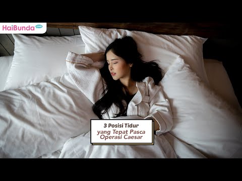 Video: 3 Cara Tidur Setelah Operasi Caesar