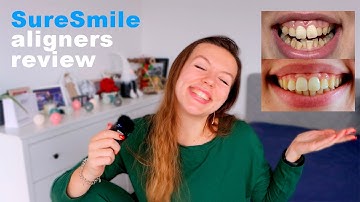 My SureSmile aligners experience | cost, before & after results