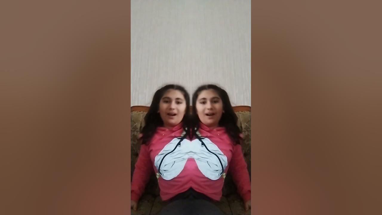 сеамские близнецы - YouTube