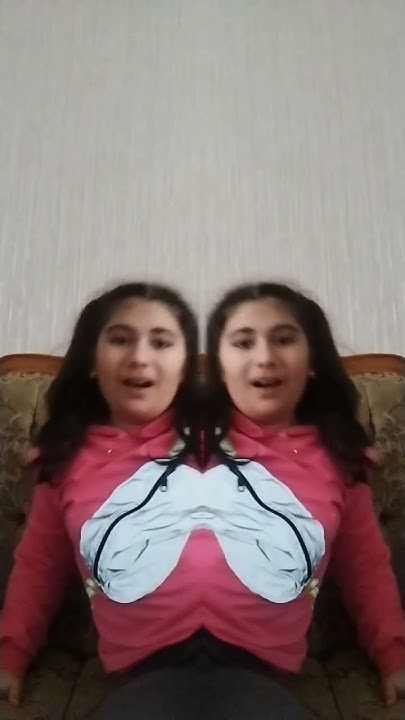 сеамские близнецы - YouTube