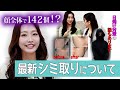 【取り放題】ぜんぶで142個！顔のシミを取って明るい印象に！！シミの天敵、日焼け対策についてもお話します！