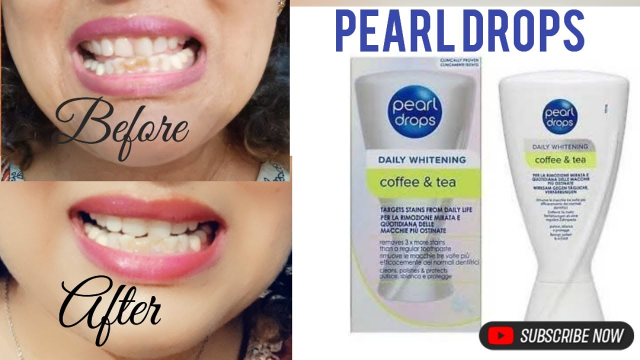 PEARL DROPS Daily Whitening Stains Remover Toothpaste Honest 💯 Review /  Before and After Tooth 