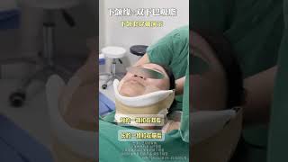 下颌缘+双下巴吸脂，这个步骤很重要 #liposuction #fyp #plasticsurgery #shaping #trending #吸脂 #viral #spa