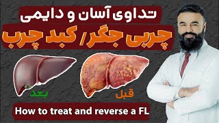 تداوی آسان و دایمی چربی جگر/کبد چرب| دکتور قیس نیکزاد