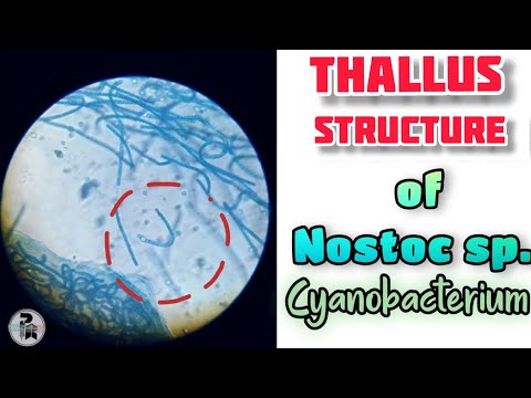 Nostoc sp. thallus 구조 || 시아 노박 테 리움 (Nostoc sp.)의 실제 연구