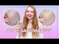 The Best Acne Safe Foundation (Amazing Acne Coverage)