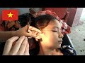 🇻🇳ベトナムの耳かき（耳そうじ）
